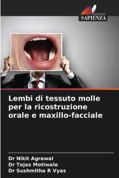 Lembi di tessuto molle per la ricostruzione orale e maxillo-facciale - Agrawal, Dr Nikit;Motiwale, Dr Tejas;Vyas, Dr Sushmitha R