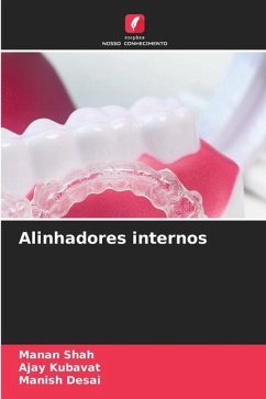 Alinhadores internos - Shah, Manan;KUBAVAT, AJAY;Desai, Manish