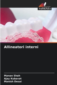 Allineatori interni - Shah, Manan;KUBAVAT, AJAY;Desai, Manish