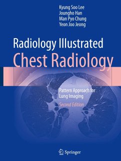 Radiology Illustrated: Chest Radiology - Lee, Kyung Soo;Han, Joungho;Chung, Man Pyo