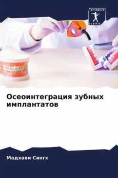 Oseointegraciq zubnyh implantatow Cover Oseointegraciq zubnyh implantatow