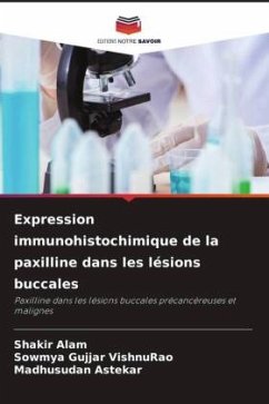 Expression immunohistochimique de la paxilline dans les lésions buccales - Alam, Shakir;Gujjar VishnuRao, Sowmya;Astekar, Madhusudan
