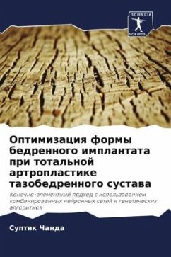 Optimizaciq formy bedrennogo implantata pri total'noj artroplastike tazobedrennogo sustawa - Chanda, Suptik