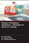 Échecs d¿implants dentaires : étiologie et prise en charge