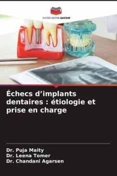 Échecs d¿implants dentaires : étiologie et prise en charge - Maity, Dr. Puja;Tomer, Dr. Leena;Agarsen, Dr. Chandani