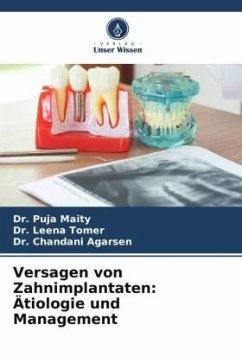 Versagen von Zahnimplantaten: Ätiologie und Management - Maity, Dr. Puja;Tomer, Dr. Leena;Agarsen, Dr. Chandani