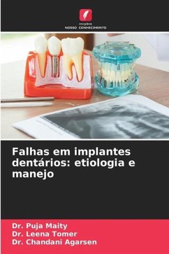 Falhas em implantes dentários: etiologia e manejo - Maity, Dr. Puja;Tomer, Dr. Leena;Agarsen, Dr. Chandani