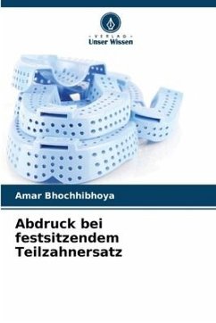 Abdruck bei festsitzendem Teilzahnersatz - Bhochhibhoya, Amar