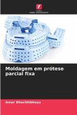 Moldagem em prótese parcial fixa