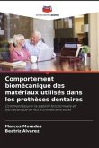 Comportement biomécanique des matériaux utilisés dans les prothèses dentaires