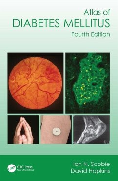 Atlas of Diabetes Mellitus - Scobie, Ian N.; Hopkins, David