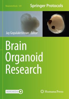 Brain Organoid Research