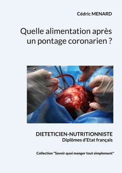 Quelle alimentation après un pontage coronarien ? (eBook, ePUB) - Menard, Cédric