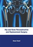 Hip and Knee Reconstructive and Replacement Surgery