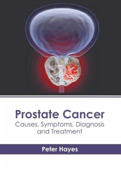 Prostate Cancer: Causes, Symptoms, Diagnosis and Treatment
