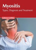 Myositis: Types, Diagnosis and Treatment Myositis: Types, Diagnosis and Treatment