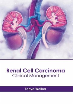 Renal Cell Carcinoma: Clinical Management