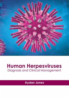 Human Herpesviruses: Diagnosis and Clinical Management