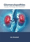 Glomerulopathies: Causes, Pathology and Treatment Glomerulopathies: Causes, Pathology and Treatment