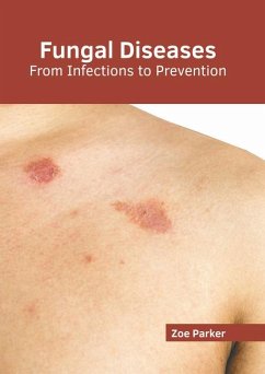 Fungal Diseases: From Infections to Prevention