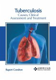 Tuberculosis: Causes, Clinical Assessment and Treatment