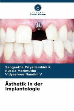 Ästhetik in der Implantologie - K, Sangeetha Priyadarshini;Marimuthu, Russia;V, Vidyashree Nandini