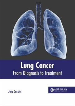 Lung Cancer: From Diagnosis to Treatment