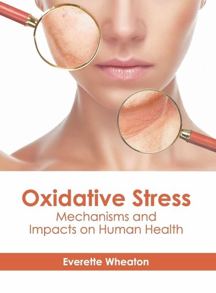 Oxidative Stress: Mechanisms and Impacts on Human Health Oxidative Stress: Mechanisms and Impacts on Human Health