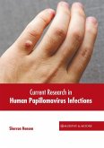 Current Research in Human Papillomavirus Infections