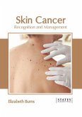 Skin Cancer: Recognition and Management