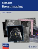 Radcases Breast Imaging (eBook, ePUB)