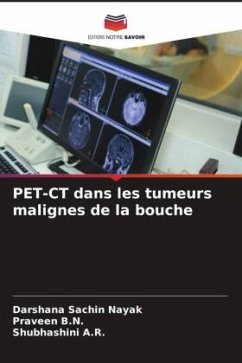 PET-CT dans les tumeurs malignes de la bouche - Nayak, Darshana Sachin;B.N., Praveen;A.R., Shubhashini