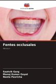 Fentes occlusales