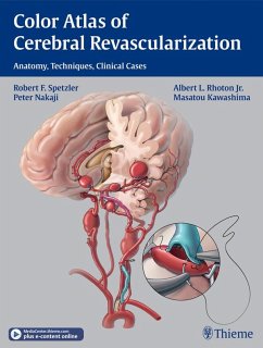 Color Atlas of Cerebral Revascularization (eBook, ePUB) - Spetzler, Robert F.; Rhoton, Albert L.; Nakaji, Peter; Kawashima, Masatou
