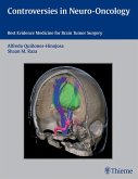 Controversies in Neuro-Oncology (eBook, ePUB)