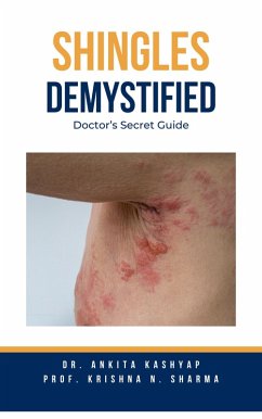 Shingles Demystified: Doctor's Secret Guide (eBook, ePUB) - Kashyap, Ankita; Sharma, Krishna N.