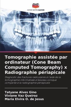 Tomographie assistée par ordinateur (Cone Beam Computed Tomography) x Radiographie périapicale - Alves Gino, Tatyane;Vaz Queiroz, Viviane;O. de Jesus, Maria Elvira