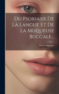 Du Psoriasis De La Langue Et De La Muqueuse Buccale... - Mauriac, Charles