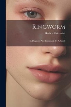 Ringworm: Its Diagnosis And Treatment, By A. Smith - Aldersmith, Herbert