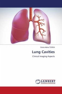 Lung Cavities