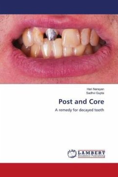 Post and Core