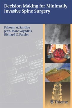 Cover Decision Making for Minimally Invasive Spine Surgery (eBook, ePUB)