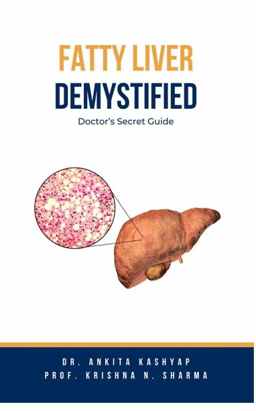 Fatty Liver Demystified: Doctor's Secret Guide (eBook, ePUB) Fatty Liver Demystified: Doctor's Secret Guide (eBook, ePUB)