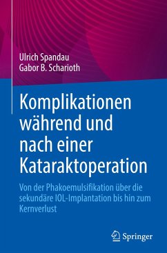 Komplikationen während und nach einer Kataraktoperation - Spandau, Ulrich;Scharioth, Gabor B.