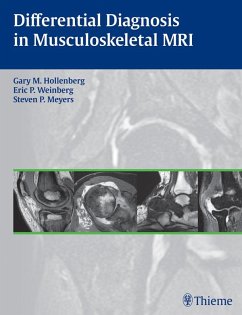 Cover Differential Diagnosis in Musculoskeletal MRI (eBook, ePUB)