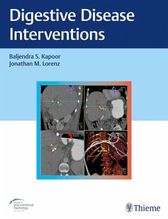 Cover Digestive Disease Interventions (eBook, ePUB)