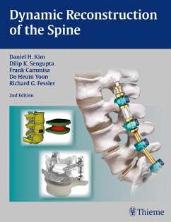 Dynamic Reconstruction of the Spine (eBook, ePUB)