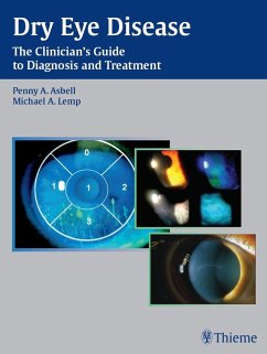 Cover Dry Eye Disease (eBook, ePUB)