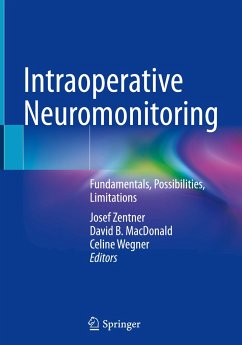 Intraoperative Neuromonitoring