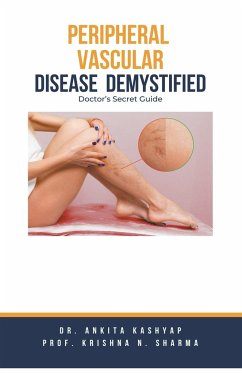 Peripheral Vascular Disease Demystified - Kashyap, Ankita; Sharma, Krishna N.